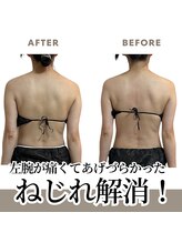 オルオル(.olu olu)/腕が上げづらい