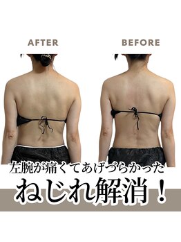 オルオル(.olu olu)/腕が上げづらい