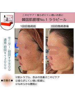 ミーカラー(mecalla.)/ララピールBA