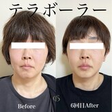 エクレクティック(ECLECTIC)