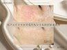 *◇人気No.2◇*【シミケア・くすみ・リフトアップ】光フェイシャル