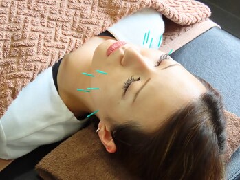 ワンドア(ONEDOOR)/【美容鍼】小顔/ターンオーバー