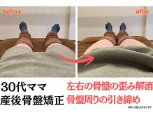 骨盤矯正で産後の歪みが整って、下半身がキュッと引き締まった！