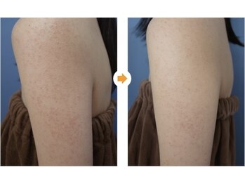 スリリアン 銀座/★お客さまビフォーアフター★