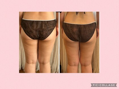 ヨサパーク ひだまり 日立店(YOSAPARK)の写真