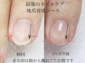 トゥインクリーネイルサロン(Twinkly Nail Salon)/【最強のネイルケア】1回お試し