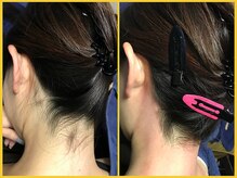 クラウン ジュエルズ(CROWN JEWELS)/【Wax脱毛】うなじ　サイド 1