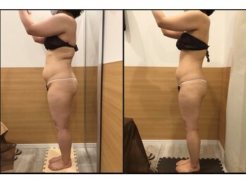 リッツ 草加店(Ritz)/【Before/After】　痩身