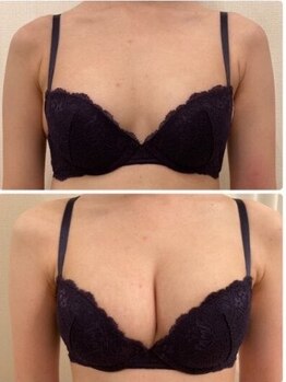 エスビューティー 三軒茶屋(S beauty)/バストケア・池尻大橋・痩身