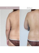 エスプリクレール(Esprit Clair)/アロマ70分　BeforeAfter