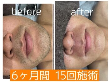 マイセルフ 福山神辺店(Myself)/