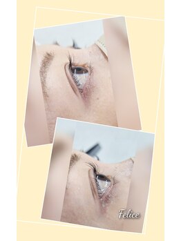 フェリーチェ(Felice)/まつげパーマ(ラッシュリフト)