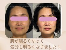 美カナエル(美kanaeru)/オーダーメイド施術