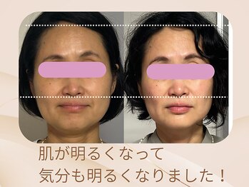 美カナエル(美kanaeru)/オーダーメイド施術