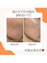 エステサロンラグジューム/Ravissa化粧品