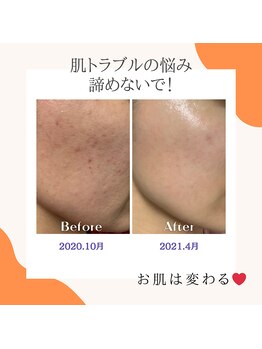 エステサロンラグジューム/Ravissa化粧品