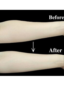 リブ(Lib)/くすみ悩みにホワイトシャイン☆