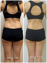 アリビオ(alivio)/腰回りもスッキリ。