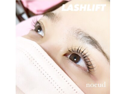 ノード(noeud)の写真