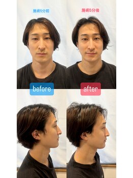 ギンパリ ヒロ トリートメントルーム エム(ginpari HIRO Treatment room M)/美調整フェイシャル