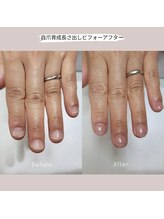 ミンスネイル(Mins Nail)/