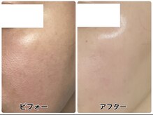 アンジェーム(angeame)/うるつや水光肌へ☆