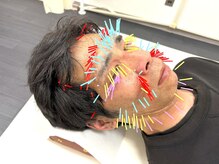 とだ鍼灸院の雰囲気（【美容鍼200本!】小顔/目のコリ/ほうれい線/たるみ/シワ改善に◎）
