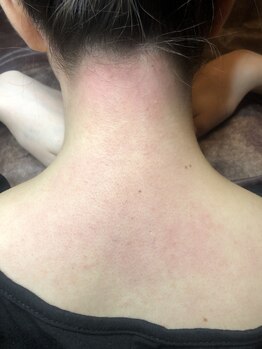 エムユー(Mu)/M字うなじ