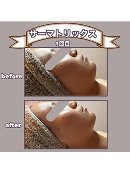 ビーマジック(美magic)/サーマトリックス