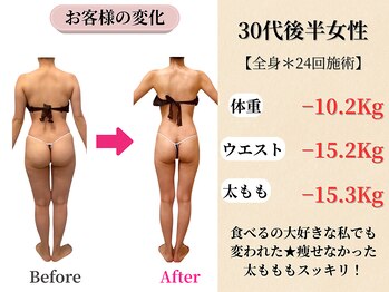 ベルホワイト(Belle White)/【30代後半/6ヶ月の変化】