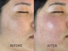 リッツ バイ クレル 錦糸町店(RITZ by CLAIR)/Wax脱毛[産毛・角質除去]