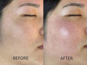 リッツ バイ クレル 錦糸町店(RITZ by CLAIR)/Wax脱毛[産毛・角質除去]