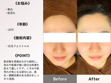 ルディラ 大宮店/白玉フェイシャル