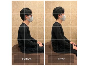 トラスト整体院 小池院/20代/男性/専門学生/めまい