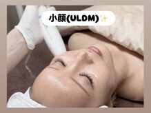 ラヴィ(Ravi)/コラーゲンフィラーUldm