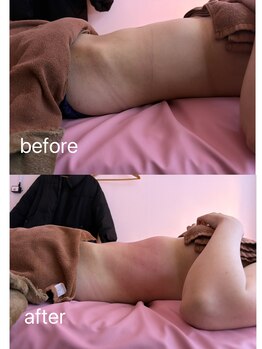 イーリバイブ/iNVYDOM MAX