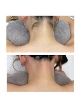 サンキュービューティーサロン 横浜関内(39 beauty salon.)/うなじWax