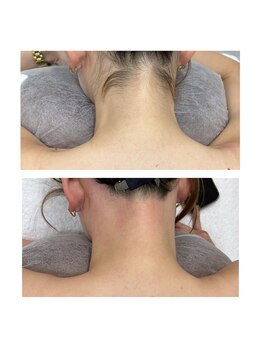 サンキュービューティーサロン 横浜関内(39 beauty salon.)/うなじWax