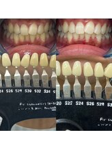 トウキョウスワーズ 池袋店(TOKYO SWRS)/#ホワイトニング #池袋 #渋谷