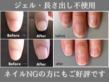 自爪ケア専門サロン イニュラ(inula)