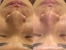 【美男毛穴】~近距離美肌~透明感のある肌へ