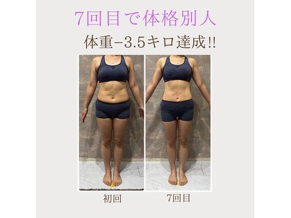 キリグ(KILIG)の写真