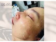 ラボーテ/老皮オフ