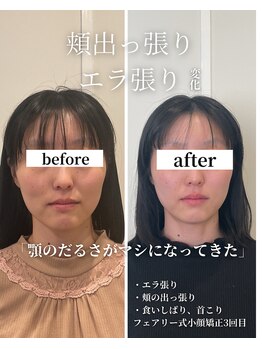 フェアリーフェイス 南森町店(Fairy Face)/南森町/小顔矯正