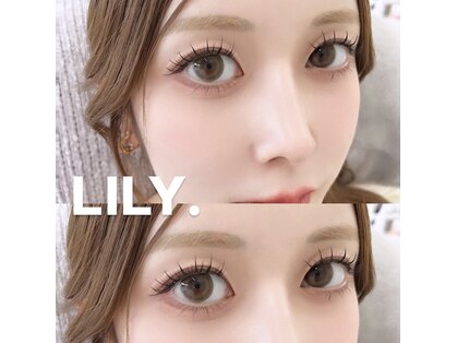 リリー(LILY.)の写真
