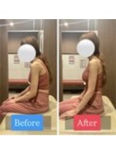 ナオル整体 宮崎院(NAORU整体)/20代女性施術事例【猫背改善】
