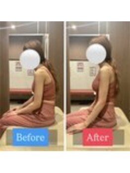 ナオル整体 宮崎院(NAORU整体)/20代女性施術事例【猫背改善】
