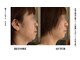 コアサロン(58SALON)の写真/【ほうれい線・たるみを引き上げ！】若々しく引き締まった理想のフェイスラインへ導きます！大人気施術◎