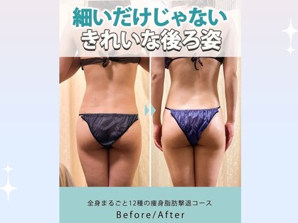 ハノハノ 八代店(HANO HANO)の写真