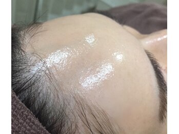 ハダハダ(HADA HADA Medical Esthetic)/顔脱毛でツルピカ韓国美肌へ★